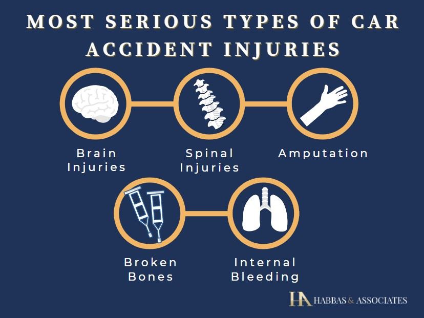 most serious car accident injuries infographic