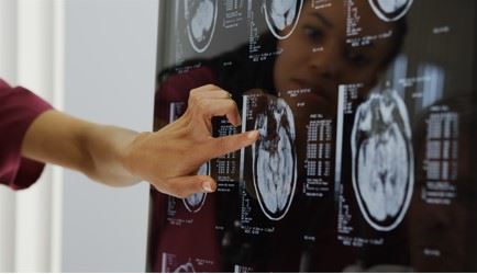woman pointing at something on a brain scan